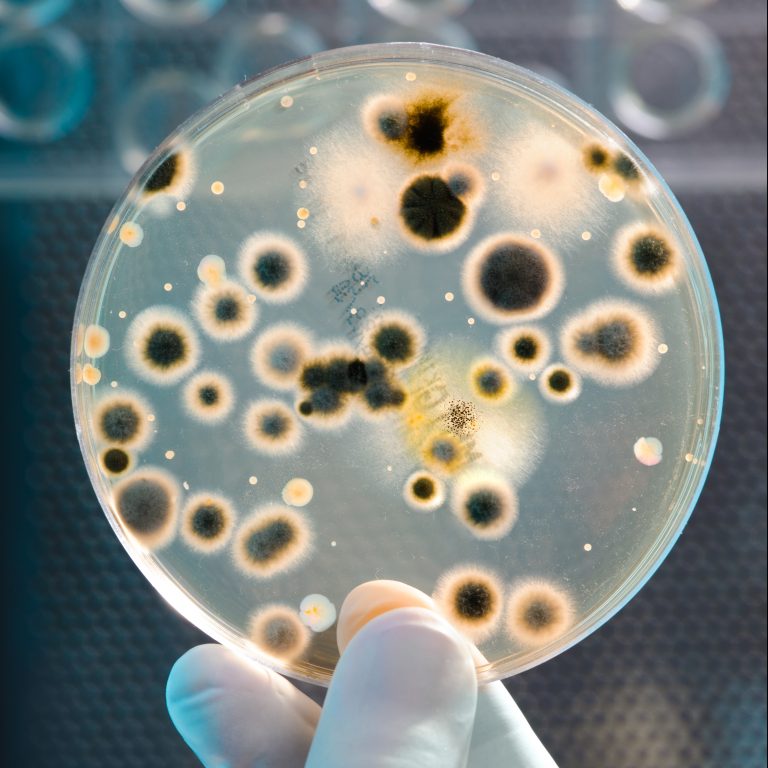 Petri dish with bacteria in a hand of scientist H.Preiss International